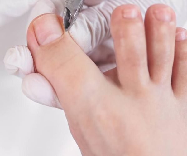 f912ad965828c6efac269764c9447c35